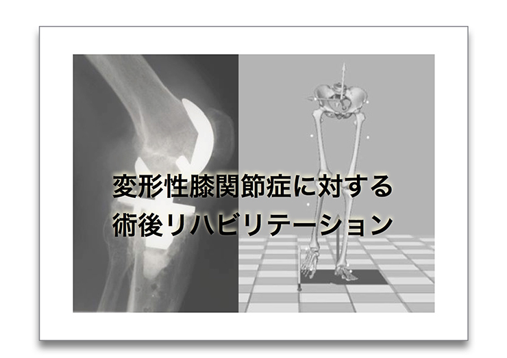 変形性膝関節症に対する術後リハビリテーション