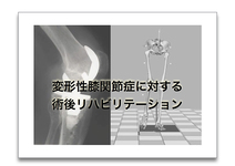 変形性膝関節症に対する術後リハビリテーション