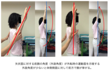 外転動作改善のためのワンポイント｜千葉慎一先生