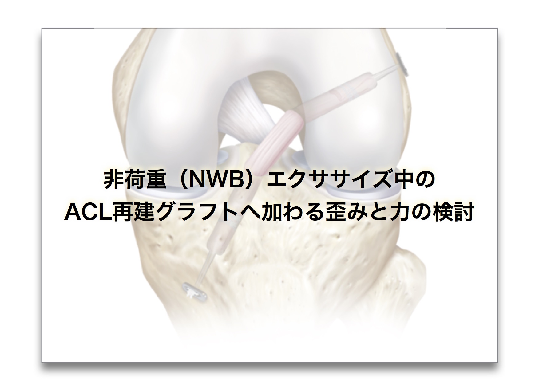 非荷重（NWB）エクササイズ中の ACL再建グラフトへ加わる歪みと力の検討【論文から学ぶエビデンス】
