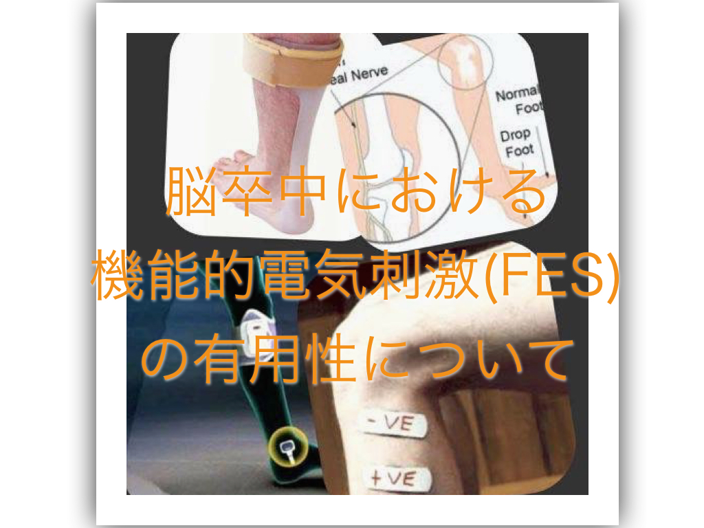 脳卒中患者における機能的電気刺激(FES)の有用性について【論文から学ぶエビデンス】