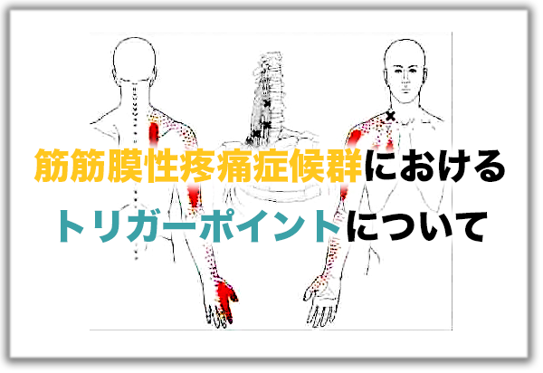 筋筋膜性疼痛症候群(MPS)におけるトリガーポイントについて【論文から学ぶエビデンス】