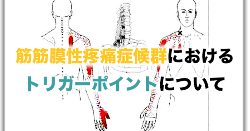 筋筋膜性疼痛症候群（MPS）におけるトリガーポイントについて【論