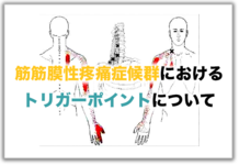 筋筋膜性疼痛症候群（MPS）におけるトリガーポイントについて【論文から学ぶエビデンス】