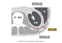 腎臓の痛みはどこに出る？