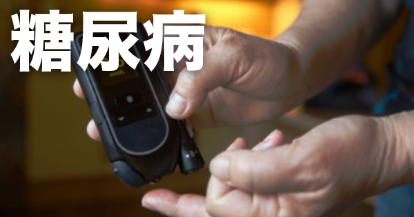 【糖尿病】HbA1cや空腹時血糖はスクリーニングに向いていない？