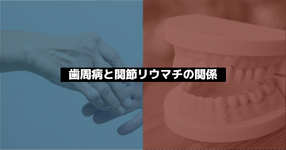 【研究紹介】関節リウマチが歯周病治療で治るかもしれない