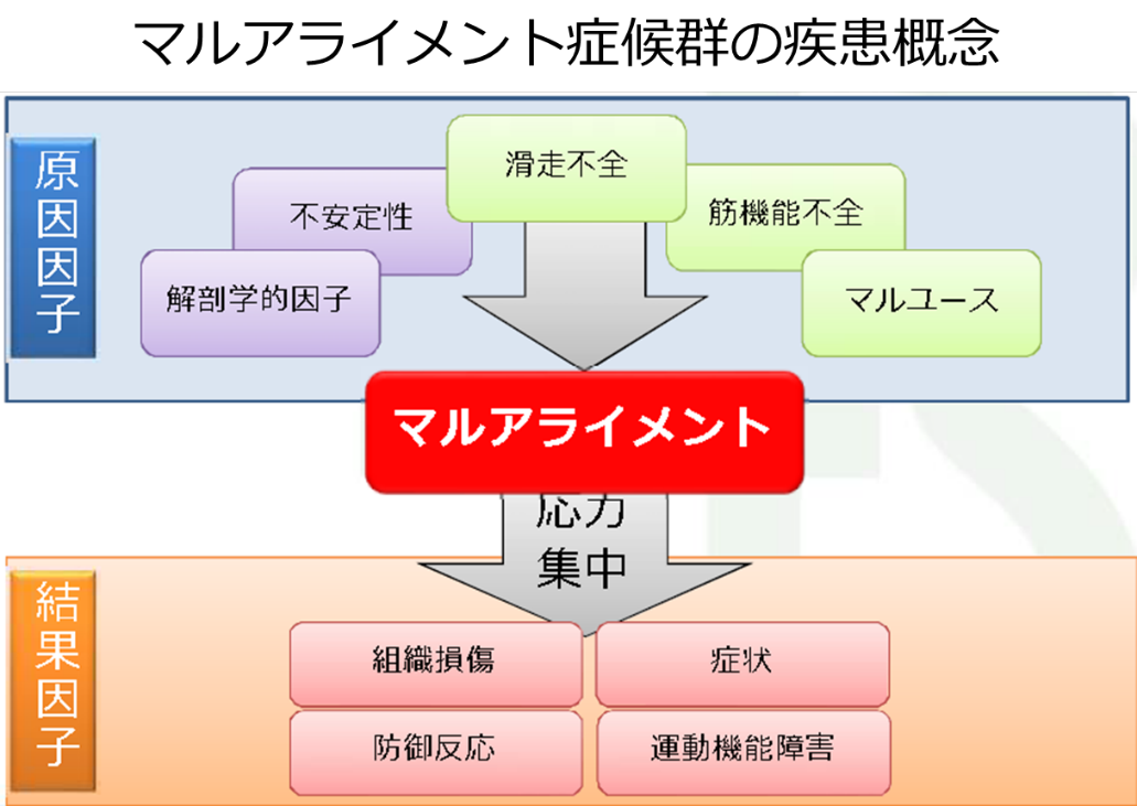 理学療法士がアライメントを変える意義と必要性