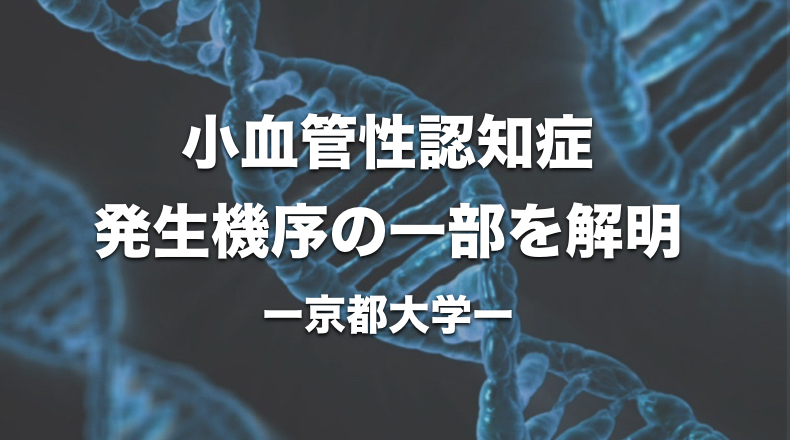小血管性認知症　発生機序の一部を解明