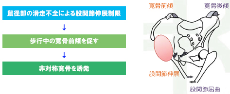 鼠径部痛症候群はリアラインで治す