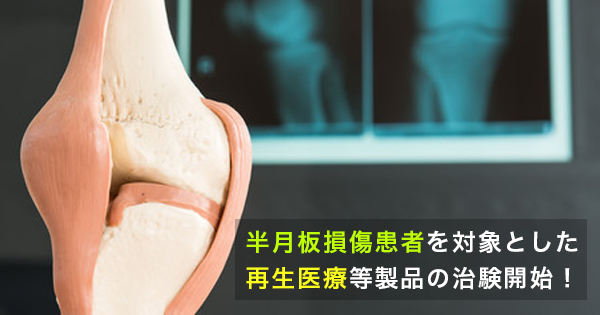 【国内初】半月板損傷患者を対象とした再生医療等製品の治験開始！