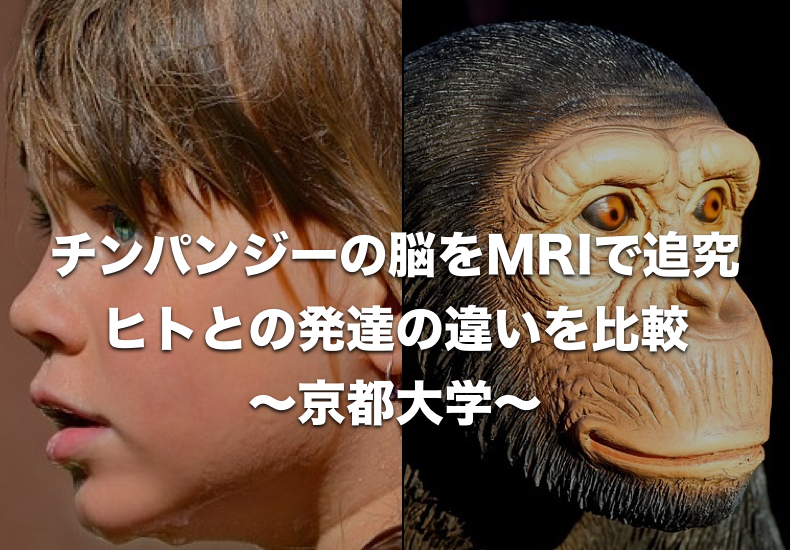 ヒトとチンパンジー｜脳梁の発達から違いを紐解く