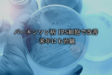 パーキンソン病 IPS細胞で改善 来年にも治験