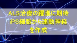 運動神経の束をiPS細胞から作成｜ALS治療の躍進に期待 