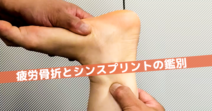 疲労骨折とシンスプリントの鑑別