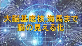 脳の「見える化」　慶大などのチーム開発