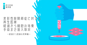 【再生医療最前線】変形性股関節症に対する間葉系幹細胞 (mesenchymal stem cell : MSC)-経過から医師の見解編-