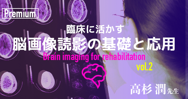 【1ヶ月基礎医学講座】24日目脳画像の読み方応用ー診断学編ー