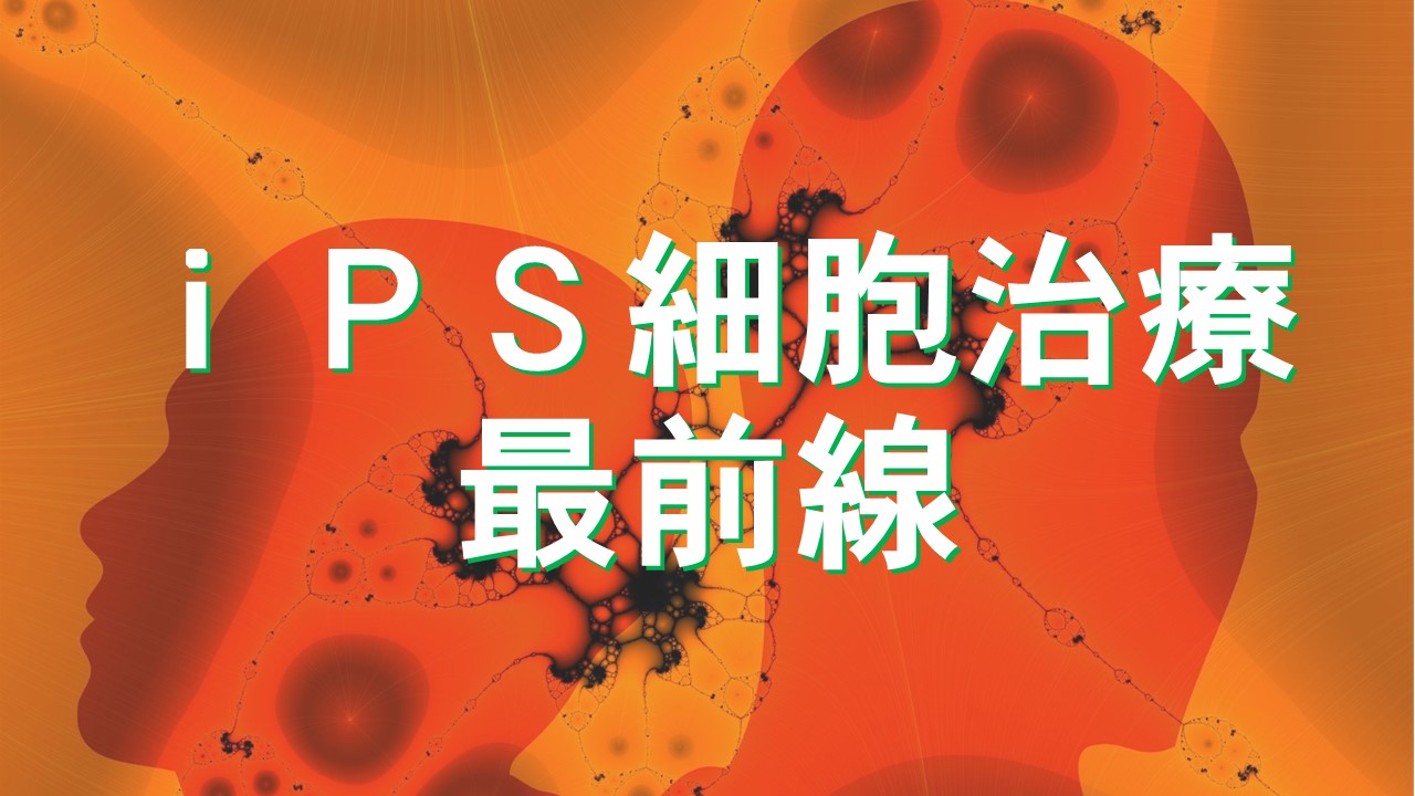 パーキンソン病患者の脳にｉＰＳ　京大