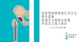 【再生医療最前線No.2】変形性股関節症に対する間葉系幹細胞 (mesenchymal stem cell : MSC)-一か八かでTHA？編