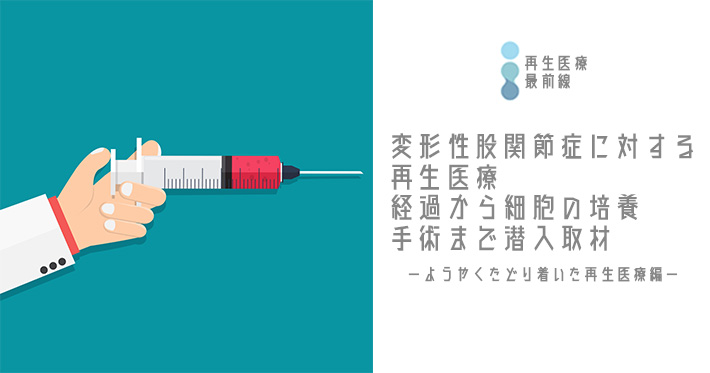 【再生医療最前線No.3】変形性股関節症に対する間葉系幹細胞 (mesenchymal stem cell : MSC)-ようやくたどり着いた再生医療編-＊術中動画あり