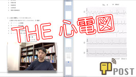 【学生向け】第53回理学療法士国家試験ー心電図ー