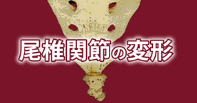 尾骨周囲の痛みのメカニズム