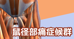 鼠径部痛発症の概念図