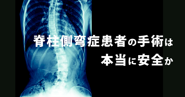 脊柱側弯症手術の安全性を検証｜富山大
