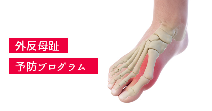 【外反母趾予防プログラム】イマイの足をチェックしてきました結果は左足が…