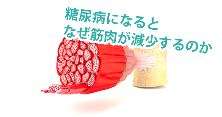 糖尿病になるとなぜ筋肉が減少するのか｜神戸大