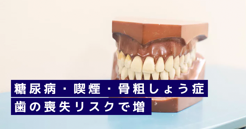 糖尿病・喫煙・骨粗しょう症で歯の喪失リスク増　教育歴や職歴も関連か