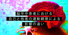 右半球損傷者の運動観察療法 自己より他者の方が効果大
