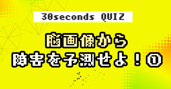 【クイズ】脳画像から障害を予測せよ！［初級編］