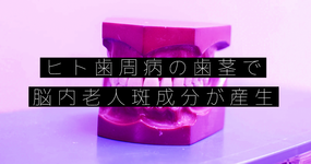 ヒト歯周病の歯茎で脳内老人斑成分が産生 九州大が発表