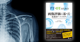 【書評】PTとOTのケーススタディを同時進行でみる
