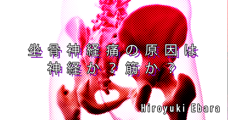 【理学療法】坐骨神経痛の原因は神経か？筋か？