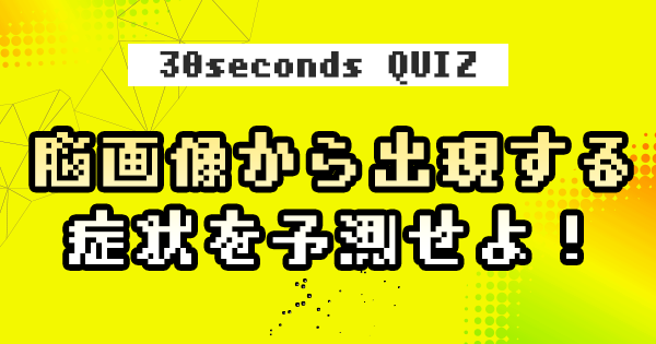 【クイズ】脳画像から出現する症状を予測せよ！