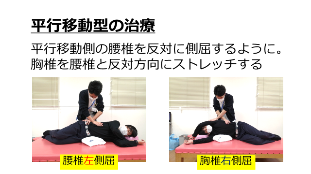 パターン別Duchenne歩行のアプローチ