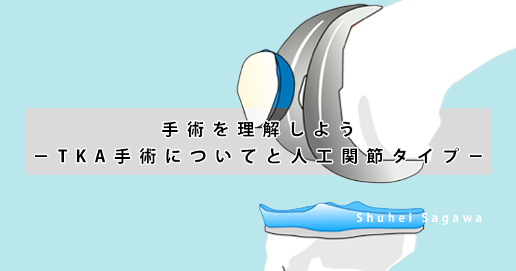 手術を理解しよう−TKA手術についてと人工関節タイプ−