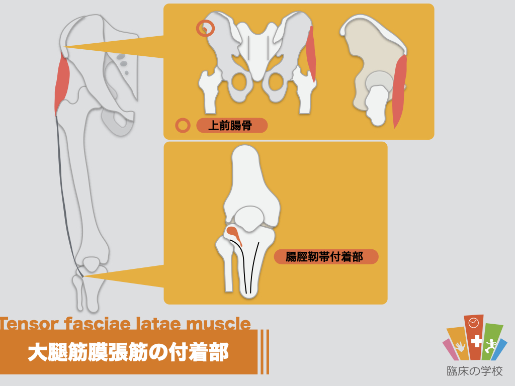 【イラスト】大腿筋膜張筋の起始・停止とストレッチ