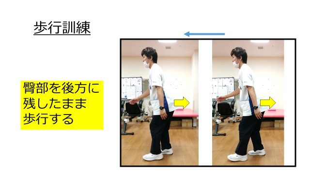 大殿筋歩行はこう治そう！