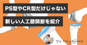 PS型やCR型だけじゃない。新しい人工膝関節を紹介。