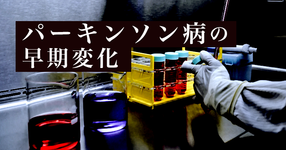 【血圧やHtなど】健診データから分かったパーキンソン病の早期変化