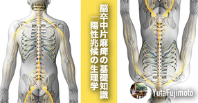 【基礎医学】脳卒中片麻痺の基礎知識｜陽性兆候の生理学