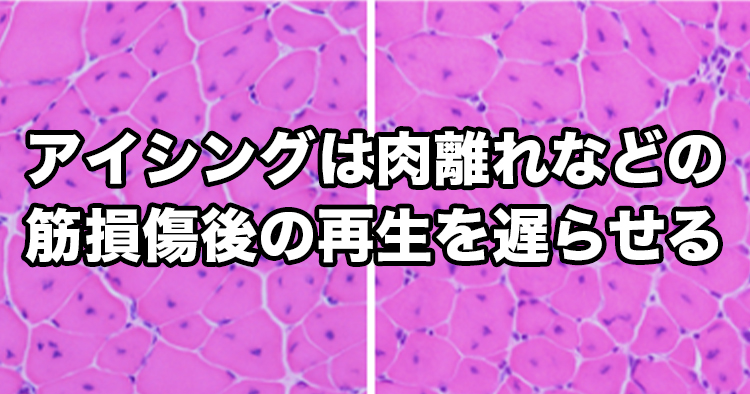 【神戸大学】アイシングは肉離れなどの筋損傷後の再生を遅らせる