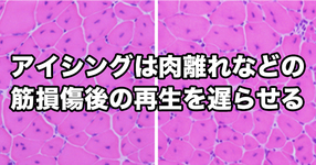 【神戸大学】アイシングは肉離れなどの筋損傷後の再生を遅らせる