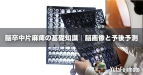 脳卒中片麻痺の基礎知識｜脳画像と予後予測