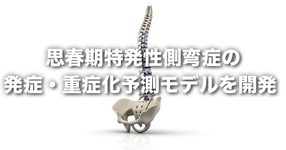 思春期特発性側弯症の発症・重症化予測モデルを開発－今後の臨床現場への応用に期待－
