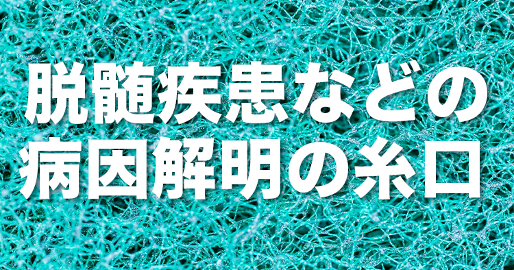 中枢神経系のミエリン形成に必須の分子を発見-脱髄疾患などの病因解明の糸口に-